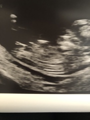 Is this the nub? If so any guesses?