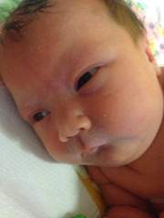 Small head/enlarged ventricles at 20 week anomaly scan - PLEASE READ