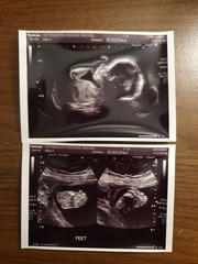 Due March 2020 - FIRST BABY in late 20's