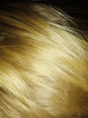 Headlice eggs? *pictures*
