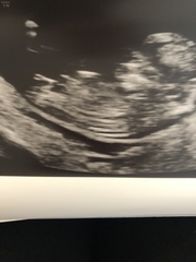 Is this the nub? If so any guesses?