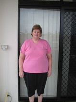 Weight loss surgery.
