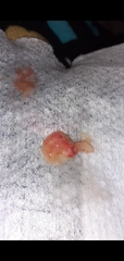 Very gross picture I just coughed this up any Docters and ENT specialists about?