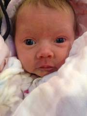 Small head/enlarged ventricles at 20 week anomaly scan - PLEASE READ