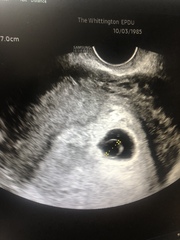 Low heart beat and big yolk sac, please help!