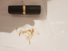 What could this be in my poo? TMI sorry. Pic included