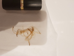 What could this be in my poo? TMI sorry. Pic included