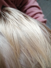 Headlice eggs? *pictures*