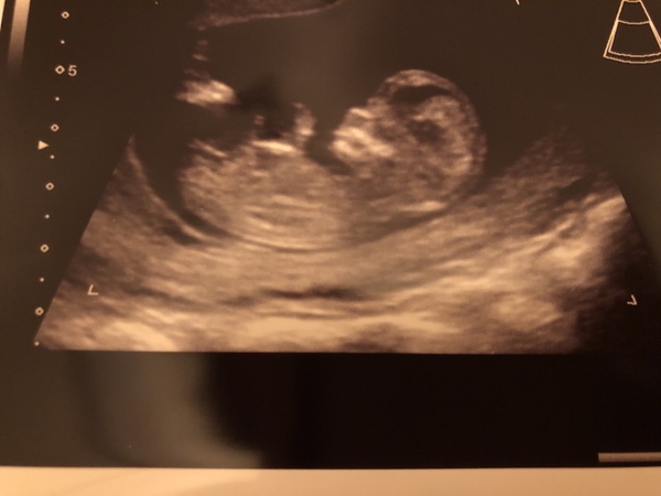 Due June 2020: Thread 2