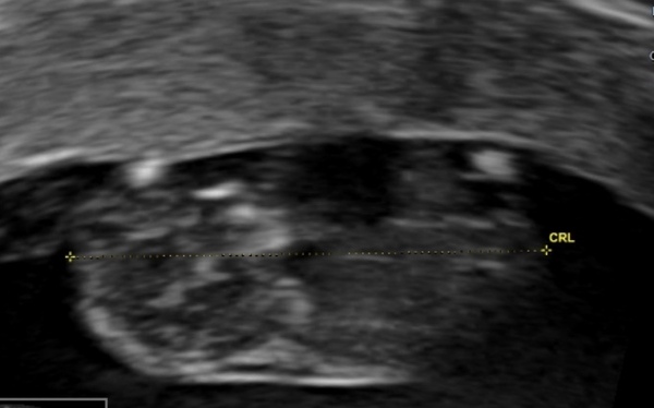 Boy or girl?