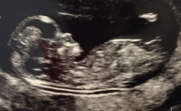 Boy or girl nub ?!