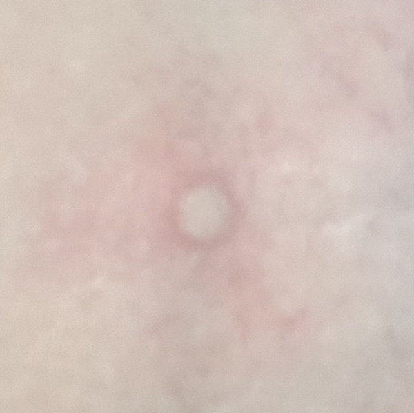 What the f causes marks like this?