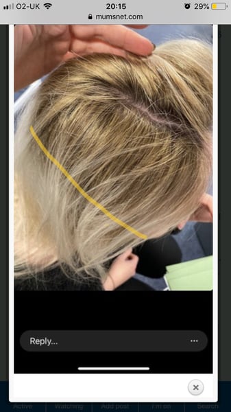 Hair related. To expect this to be fixed for free or not pay more to cover the error