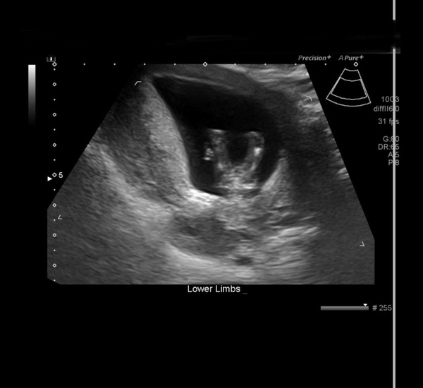 Sex of baby..