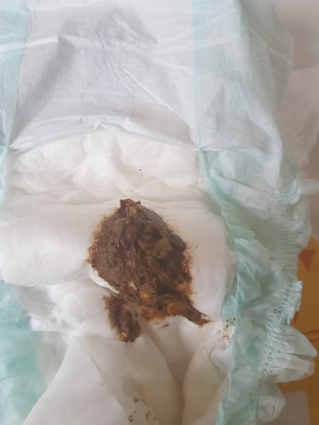 Poo thread Warning graphic imagine enclosed.
