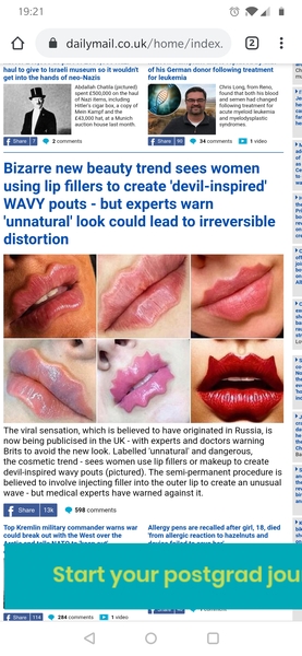 Lip Fillers