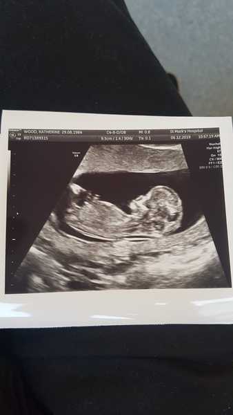 Baby gender?