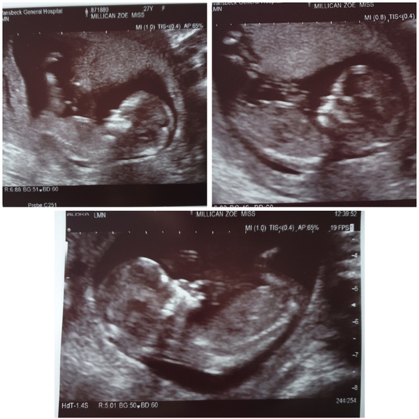 Due June 2020: Thread 2