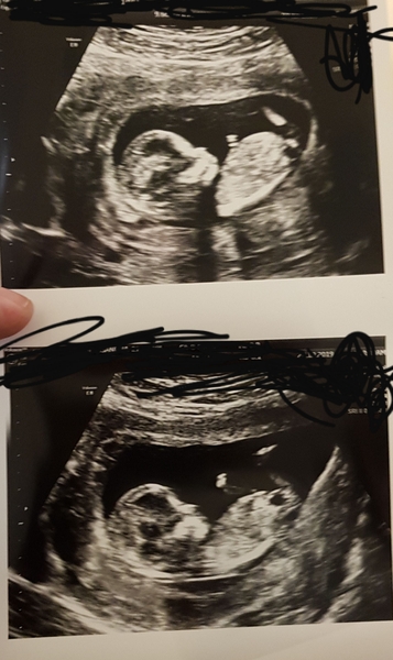 Any gender guesses please?