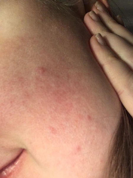 Please can you help my skin? (Pics)