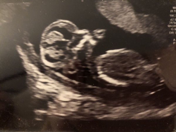 Due May 2020 (Thread 4)