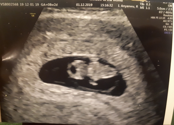 Anyone due July 2020