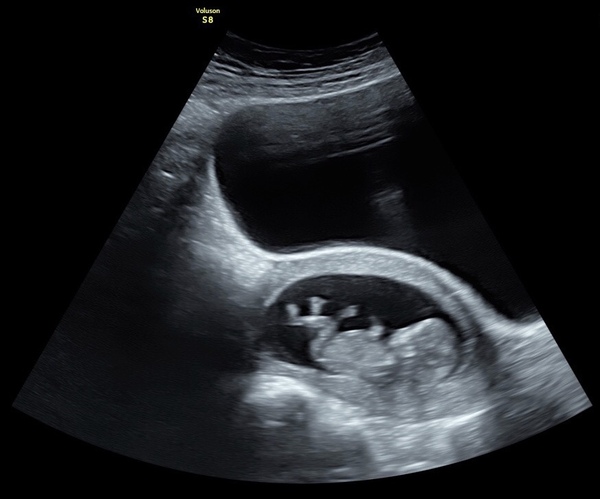 July 2020 - thread 2