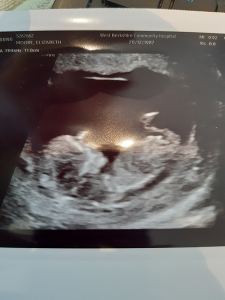Any guesses on gender?