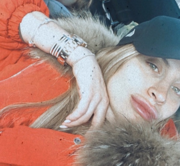 Lip Fillers