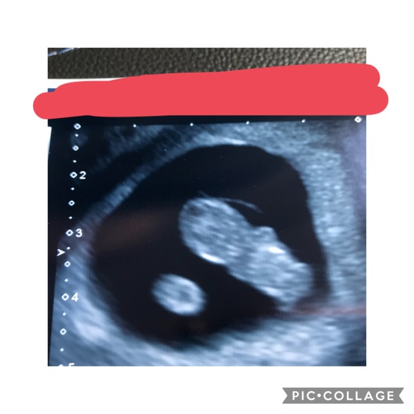 Early private scan