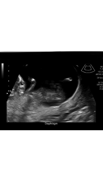 Baby gender?