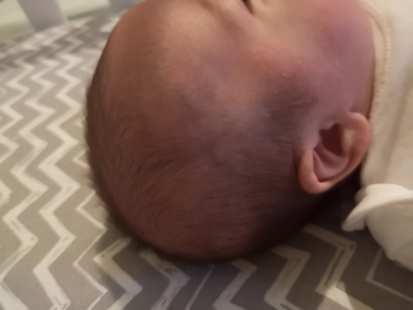 12 week olds head