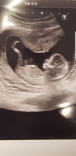 Due June 2020: Thread 2