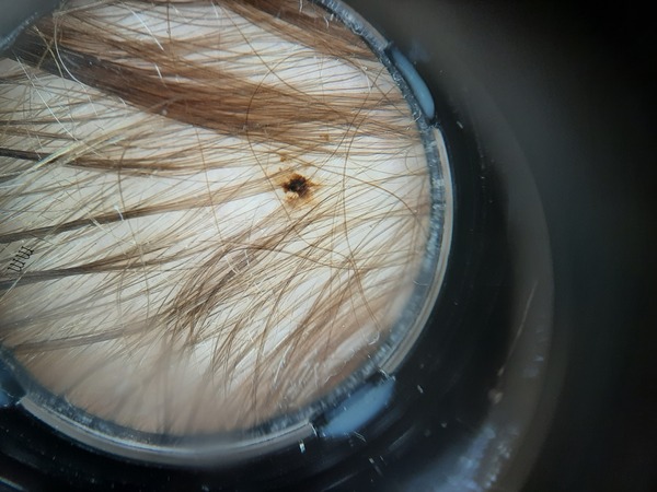 Mark on skin growing