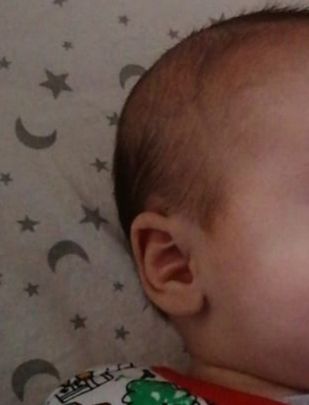 12 week olds head