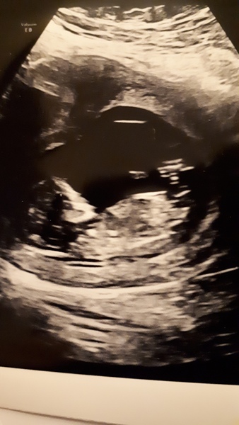 Gender guesses for fun 🧐