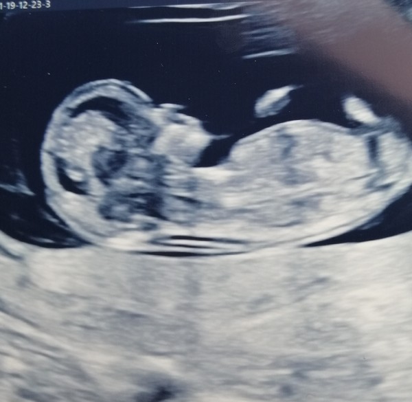 July 2020 - thread 2