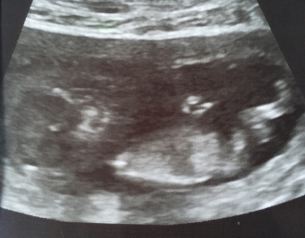 Any gender guesses? :)