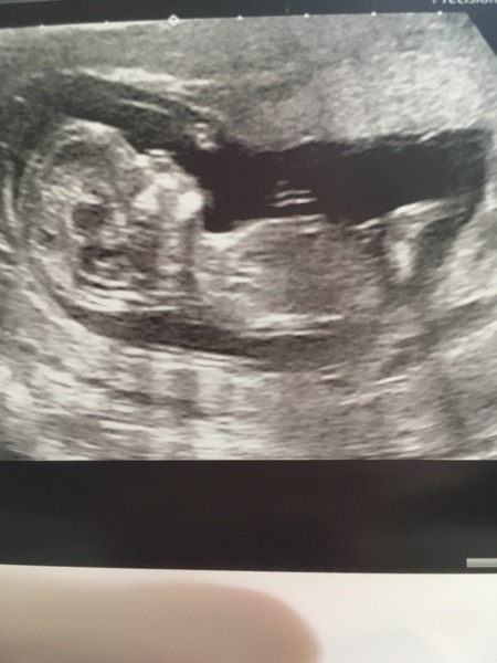 Boy or girl nub ?!