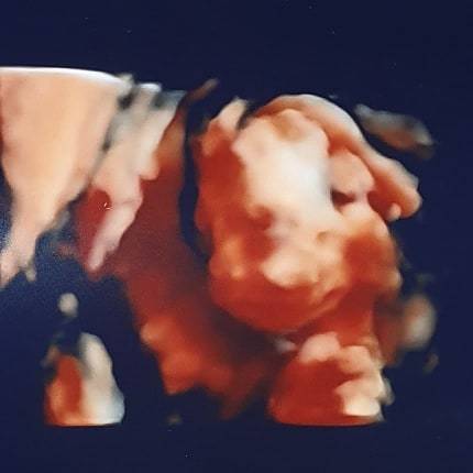 Due May 2020 (Thread 4)