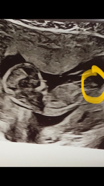Gender theory BOY OR GIRL?