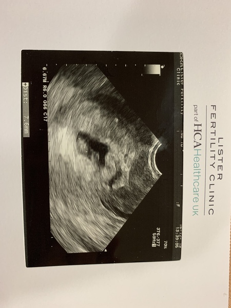 Anyone due August 2020?