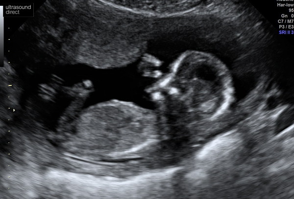 Gender guesses for fun 🧐