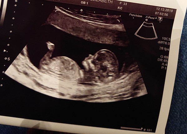 October ICSI/IVF