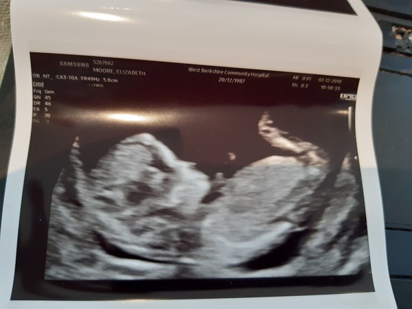 Any guesses on gender?