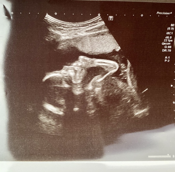 Due May 2020 (Thread 4)