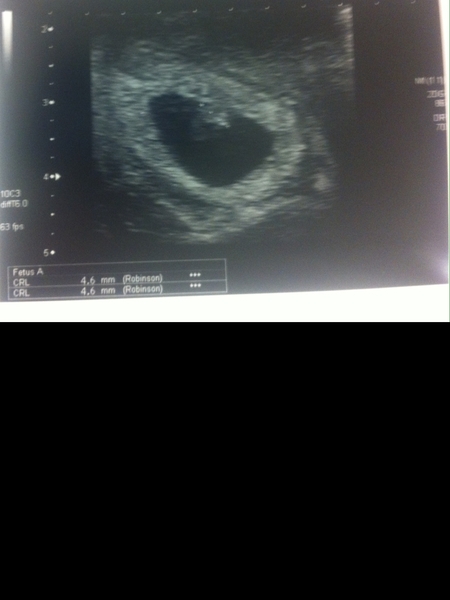 Early Scan