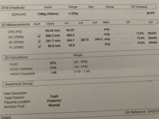 Help with these results