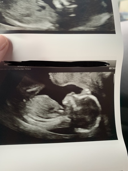 Calling all Gender guesses