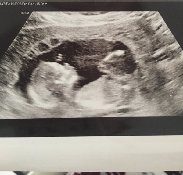 Due May 2020 (Thread 4)